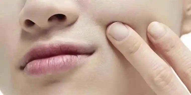 颜色暗淡,个别部位干燥脱皮甚至有细小褶皱的,上妆起皮不服帖,易敏感