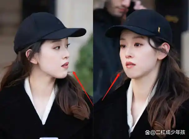 整了章泽天产后憔悴变脸牙齿突出似龅牙妹一身名牌超7万