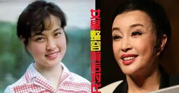 62岁蔡明上综艺,脸僵硬像变了个人