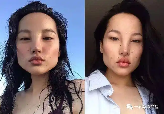 整容失败女明星盘点整容天坑别乱入