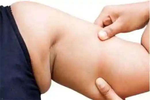 副乳可能是由于患者先天性发育出现异常,或者遗传因素引起的,进而使