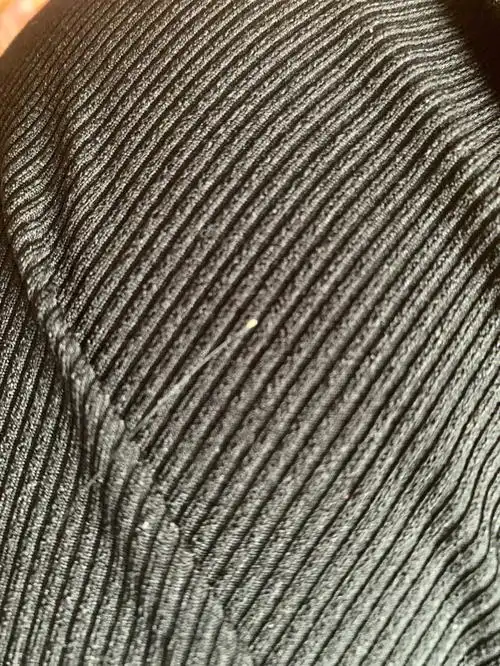 发根的这是啥是油脂还是毛囊