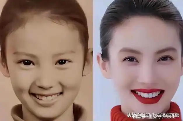 其实金晨之所以能有如此成就,并不是因为通过整容来获取观众的喜爱,这