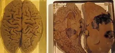 显微镜下的爱因斯坦大脑图像