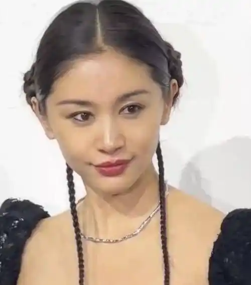 37岁王子文大变样!脸部肿胀扭曲不敢认,网友辣评:医美后遗症