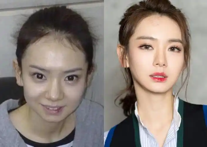 不过我觉得戚薇虽然脸变了不少,但变得更多的却还是她的穿搭和妆容