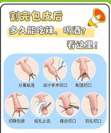 包茎手术后恢复有几个阶段