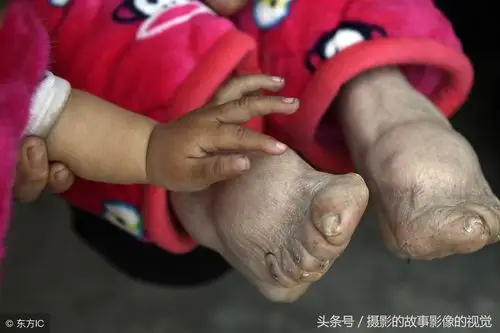 农村夫妻双双百岁五世同堂7个孩子失去看看老人的长寿经