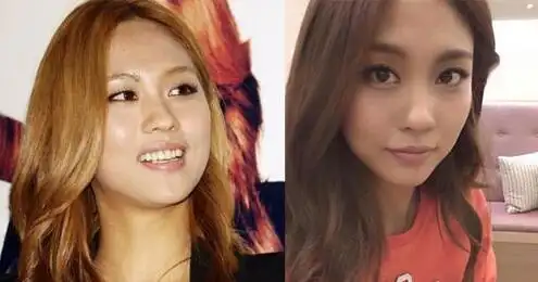 【图】王霏霏整容了吗? 王霏霏整容前后对比照