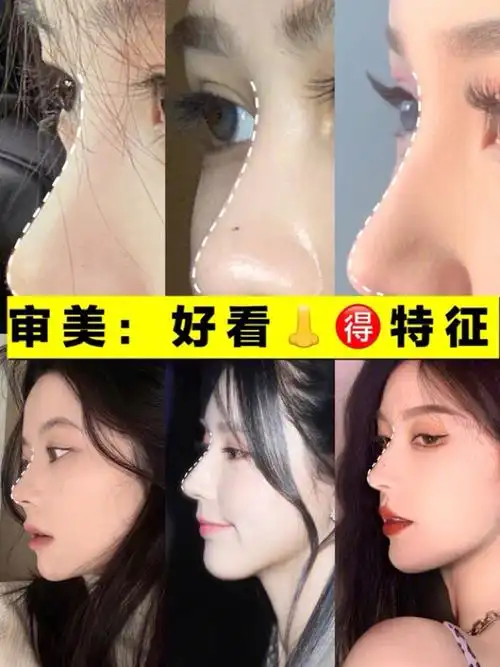 鼻部审美60好看的鼻子有哪些特征63