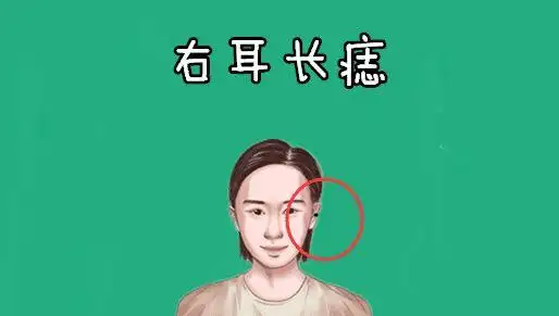 而痣的位置不同,就会有"左右有财"的说法,而女人右耳的位置处长有吉痣
