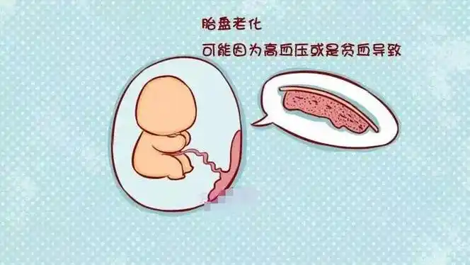 各位孕妈心里一定要有杆秤|胎盘|分娩|孕妈_新浪新闻