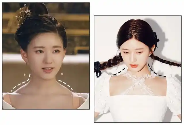 赵露思肩膀上的"肉坨",竟然消失了?