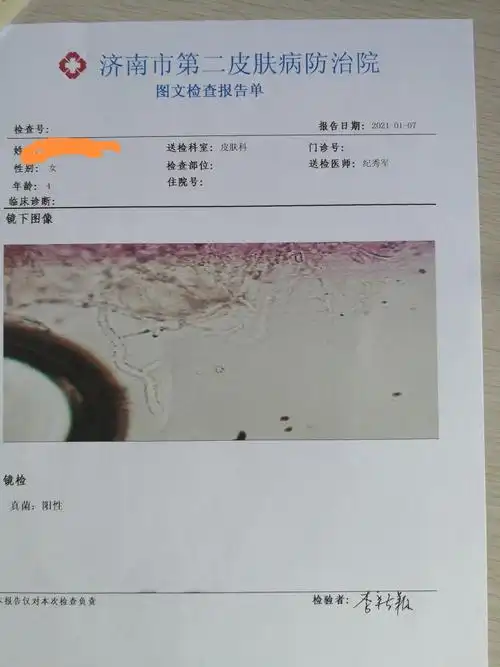 看了这个内容你也能诊断这种皮肤病了