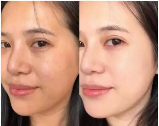 原创改善肤色暗沉的4个小技巧让皮肤嫩白透亮养成素颜发光肌