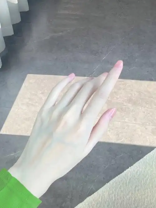 如何让手变白变漂亮?其实你也可以哦