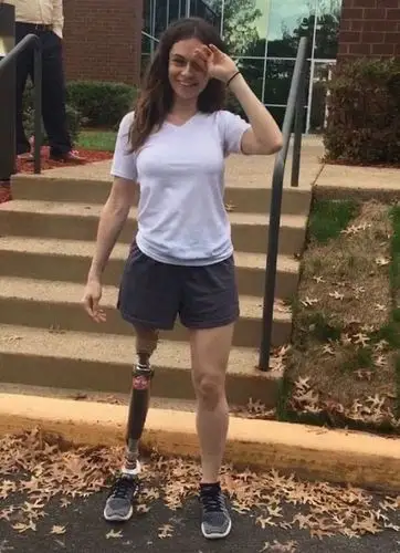 图为装上假肢她依然漂亮,自信.