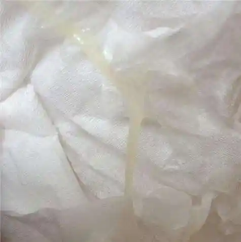 重庆仁爱医院讲解 白带带血的原因有哪些