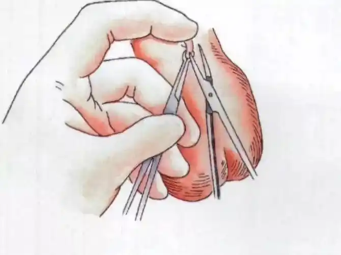 药娃温馨提示:各位亲亲小伙伴,不论是口服避孕药,还是上环或者结扎,都