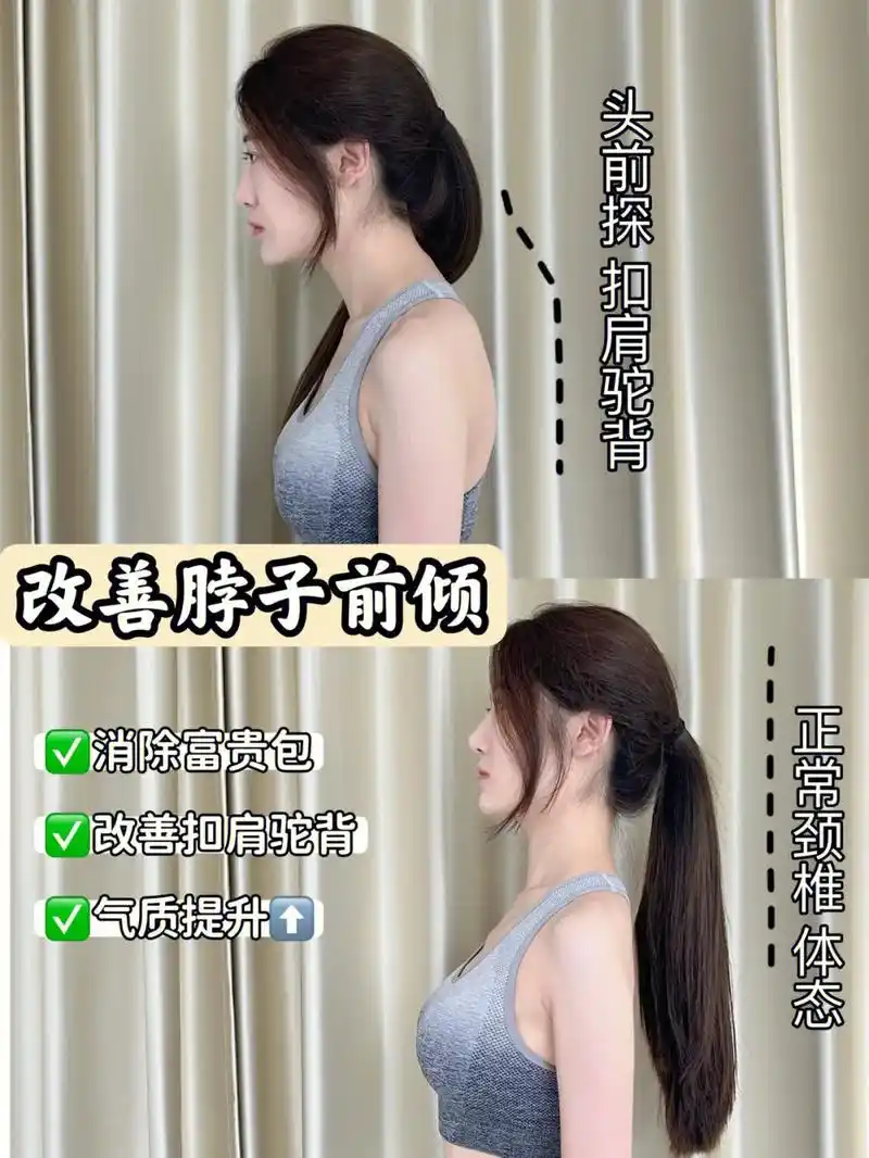 打造气质肩颈73改善脖子前倾圆肩驼背富贵包.