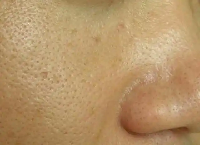 日常应避免4个护肤"雷区",皮肤暗沉无光,毛孔越来越粗大