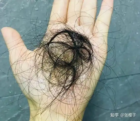 每天洗头掉一堆头发?不知道怎么选防脱洗发水?