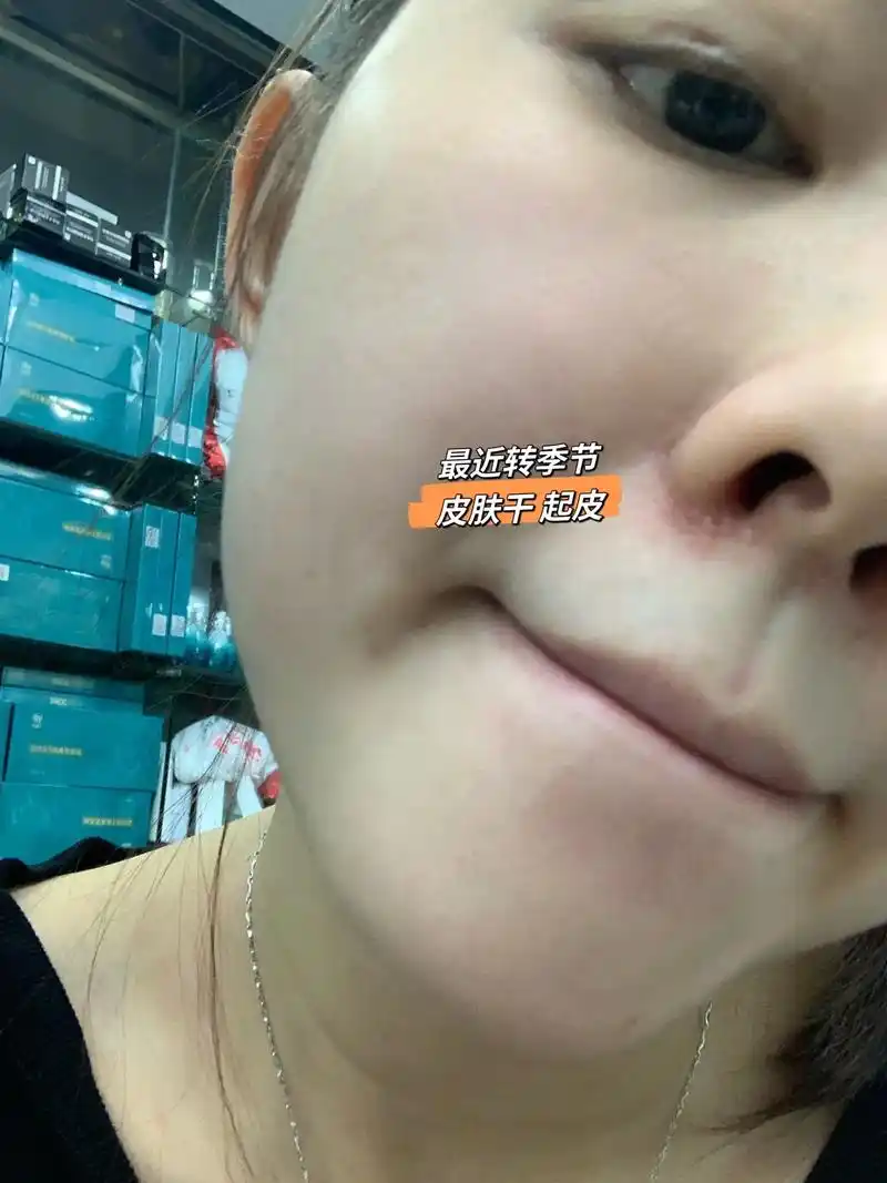 最近的冷空气皮肤起皮干痒干燥被种草的皮肤方法第二天的皮肤爱了原