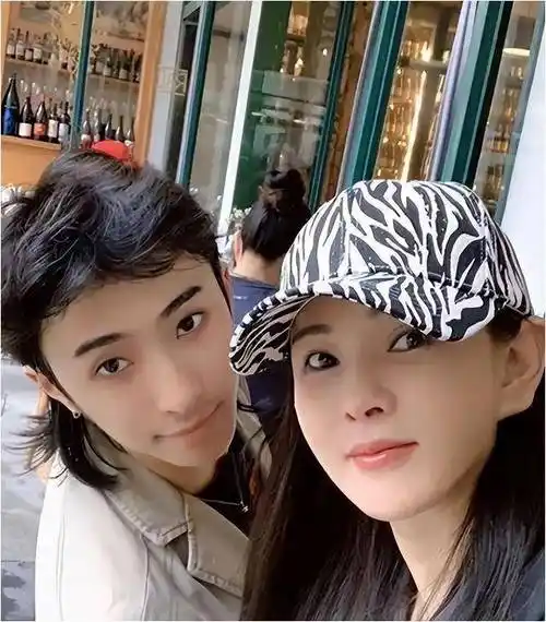 秦昊妻子韩国打水光针,伊能静56岁满脸针眼,感慨:实在太痛苦了_美容