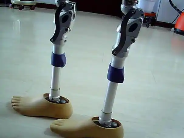 假肢髋离断大腿假肢装配案例大腿假肢大腿假肢装配需要注意的问题世界