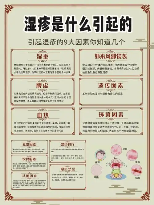 引起湿疹的九大原因你知道几个