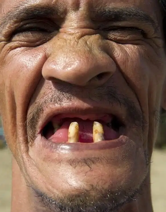 "丑男大赛"(reign of the ugly)哥伦比亚举行,19名选手比拼自己的"丑