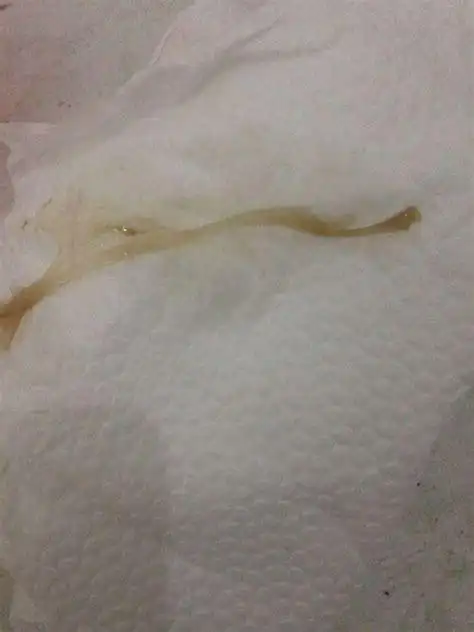 白带异常吃什么才会好