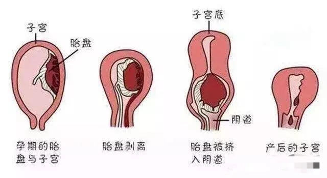 教你甩掉松弛的大肚腩,让子宫恢复如初做年轻漂亮辣妈.