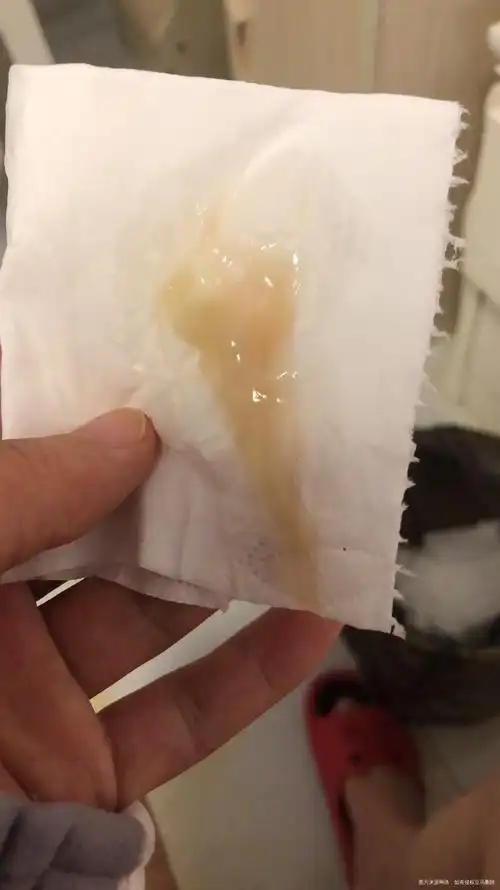 有分泌物照片介意的慎点孕39周昨天突然流像