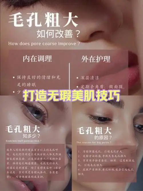 如何改善毛孔粗大