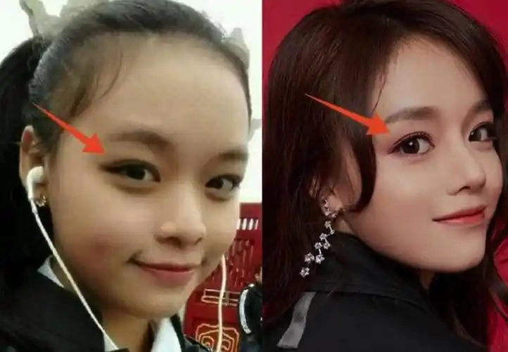 黄霄云长相变化有点大对比图黄霄云为什么叫面包