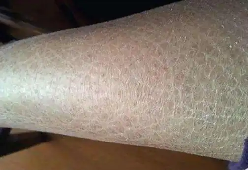 一到冬天,全身皮肤干燥又掉屑!试试洗澡加点它,让你不干又不痒