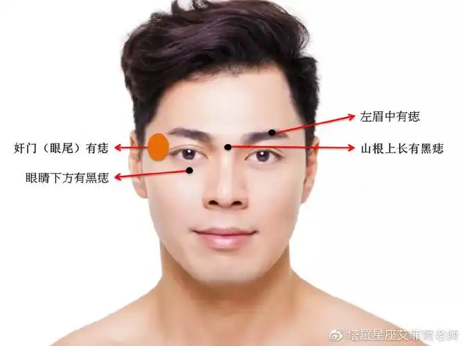 不能嫁男人脸上有这个痣嫁娶千万要三思