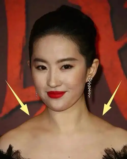 斜方肌增厚姿势矫正