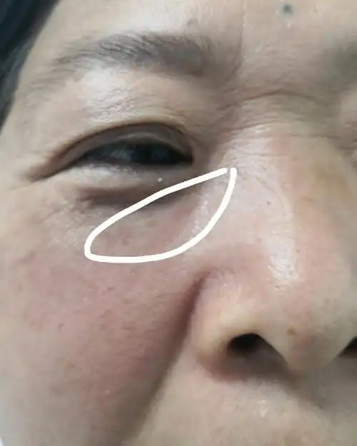 解决皮肤问题专注皮肤美容##接触性皮炎##红斑狼疮