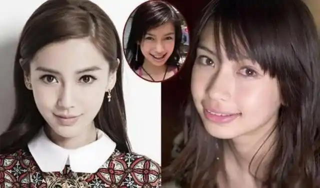 不管是普通人还是明星,可能都会为了爱美选择整容