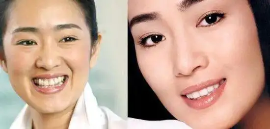 巩俐出道已经拔掉一颗虎牙了,后来又箍了牙齿.