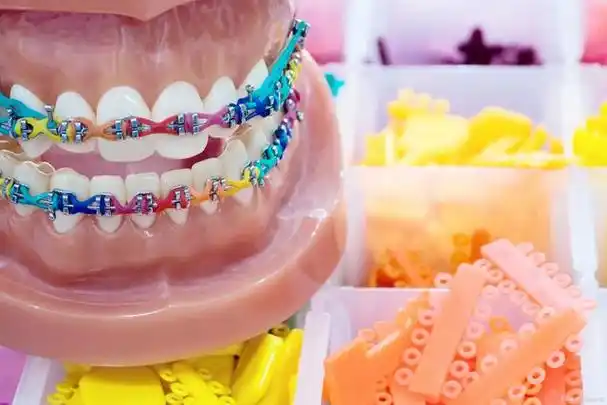 儿童牙齿矫正器:保护牙齿美好的未来