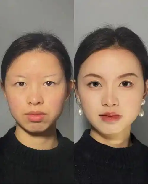 因为皮肤的好坏受到多种因素的影响,包括个人的生活习惯,环境,遗传等.