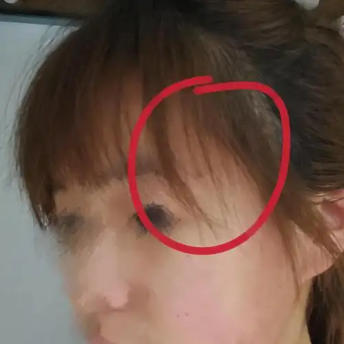 头发被打薄现在稀少成这个鬼样丑得不想见人了