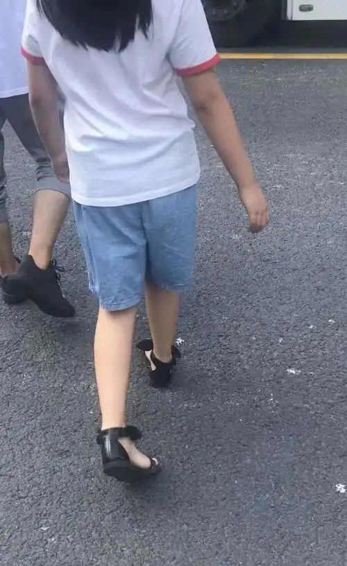 孩子内八字走路需要治疗吗