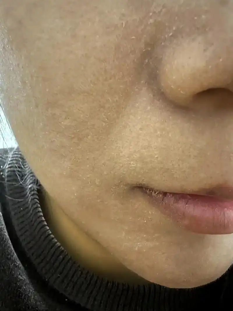 脸上长纹纹,皮肤干燥粗糙缺水,显得老!那就试试#白云山烟酰 - 抖音