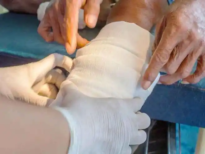 截肢|手术|创伤_网易订阅