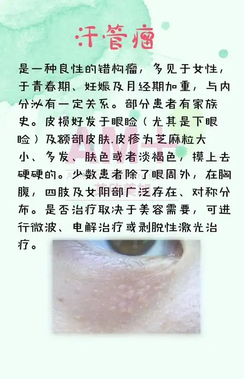 栗丘疹汗管瘤鸡皮肤怎么区分