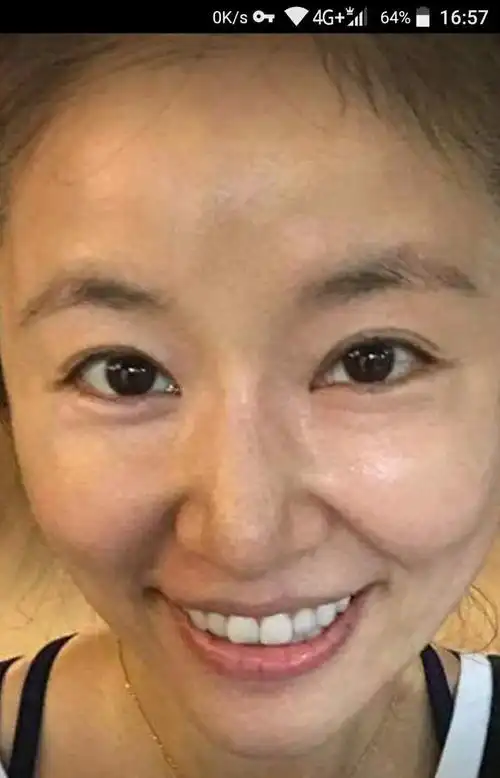 41岁林心如晒素颜照, 网友, 岁月痕迹, 依然美